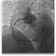KSO (Kerjasama Operasional) Cathlab - Image 3